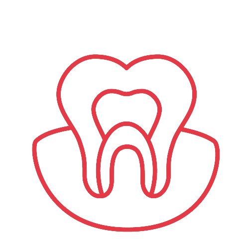 Strichzeichnung Zahnwurzel